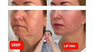 DEEP LIFTING massage  Sagging Jowls  Nasolabial Folds  Double chin [upl. by Py61]