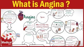 Pharmacology  What is Angina Pectoris  Types of Angina Symptoms Causes ampTreatment FROM A TO Z [upl. by Nettirb506]