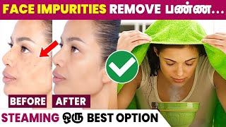 Benefits of Steaming Face  Glowing Skin at Home 😍 [upl. by Einuj]