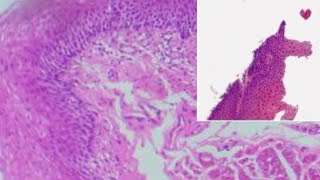 stratified squamous epithelium  مجهر طب المستنصرية [upl. by Eihs]