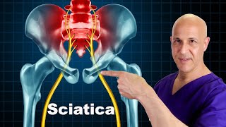 Relieve Sciatica Low Back Pain amp PInched Nerve  Dr Mandell [upl. by Benito]