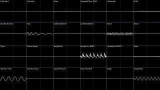 UNDERTALE  CORE Recreation  Oscilloscope View [upl. by Maria983]