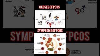 Polycystic Ovarian Syndromepcos pcod pcodtreatment pcosawareness pcosinfertility pcoslifestyle [upl. by Nomihs]