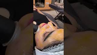 Skin rejuvenation ٫skin whitening pollagen لایه برداری پوست ژل روشن کننده [upl. by Sitelc]