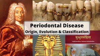 PERIODONTAL DISEASE  Origin Evolution and Classification [upl. by Amanda]