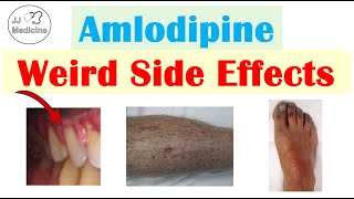 Amlodipine Weird Side Effects Skin Gastrointestinal Psychological [upl. by Ahsirak]