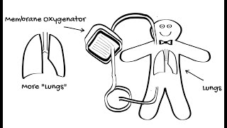 Introduction to ECMO Part 2  VV ECMO [upl. by Aniluj]