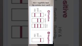 how to perform hiv syphilis test by combo card lab micro laboratory govtjob pathology bmlt lt [upl. by Genovera]