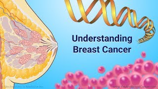 Understanding Breast Cancer [upl. by Prud]