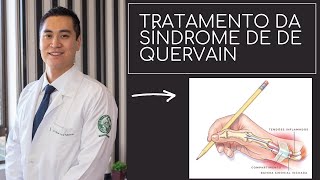 Tratamento da Síndrome de De Quervain [upl. by Kcirret]