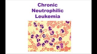 Chronic Neutrophilic Leukemia WHO 2022 [upl. by Eniarol]