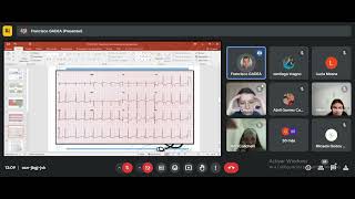 Clase de ECG cardiopatía isquémica [upl. by Ailuig]