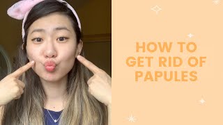 How to Get Rid of Papules  FaceTory [upl. by Nadabas]