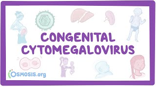 Congenital CMV  causes symptoms diagnosis treatment pathology [upl. by Ardnek]