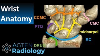 MR Anatomy Wrist  Ossicles and Compartments [upl. by Ecirtram]