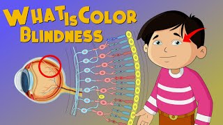 quotWhat Is Color Blindness Understanding the Vision Deficiencyquot [upl. by Tiffi434]