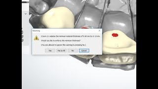 enforce minimum thickness yes or no in 3shape dental designer [upl. by Heng]