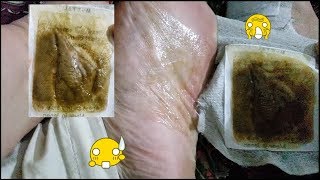 Kokubo Detox Foot Pads [upl. by Alexandria]