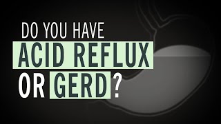 Do You Have Acid Reflux or GERD [upl. by Morna]