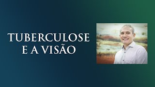 Tuberculose e a Visão  Dr Gilson Mariano  Oftalmologista [upl. by Aissej]