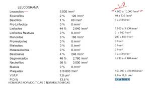 AULA 03 LEUCOGRAMA E PLAQUETOGRAMA [upl. by Aillicec]