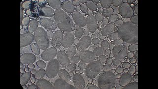 starch grains under microscope [upl. by Nyre]