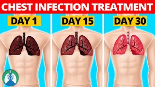 7 Natural Chest Infection Treatments Home Remedies [upl. by Anos490]