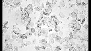 Heat Gelatinization of Wheat Starch low iodine [upl. by Demetri243]