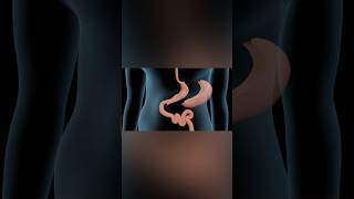 Sleeve Gastrectomy medicalanimation health shorts [upl. by Ahseken441]