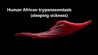 Human African Trypanosomiasis sleepingsickness Trypanosomiasis WHO [upl. by Skardol600]