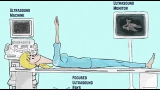 Ultrasound Therapy The Basics [upl. by Gertrude]