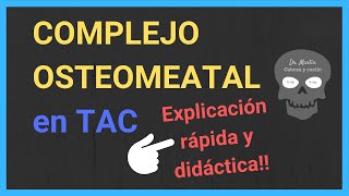 COMPLEJO OSTEOMEATAL ➡️ TAC [upl. by Aneej]