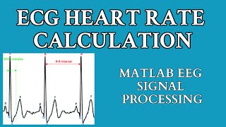 ECG Signal Processing using MATLAB  ECG Heart Rate Calculation  RPeaks Detection [upl. by Rutra]