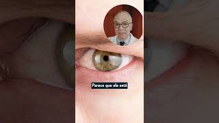 Dr Alberto Goldman  Laser Palpebras pt2 [upl. by Aber]