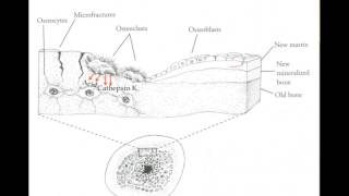 Understanding the Natural Approach to Osteoporosis  Part 1 [upl. by Adihsar]