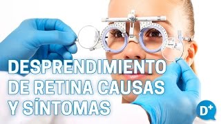 Causas y síntomas del desprendimiento de retina [upl. by Esli]