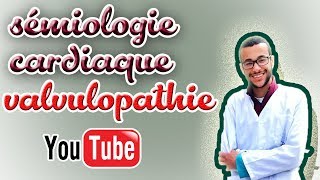 sémiologie cardiaque valvulopathie gauche [upl. by Acirema]