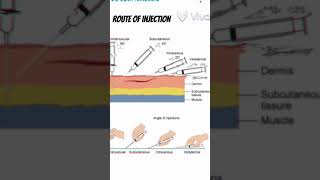 Different route of injection administration of drugs route injection shorts 3danimation viral [upl. by Pega]