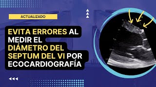 ⛔️EVITA ERRORES al medir el ✅DIÁMETRO DEL SEPTUM INTERVENTRICULAR por ecocardiografía [upl. by Greenquist17]