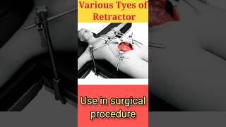 Instrument of the Day Surgical Retractors Types surgicalinstruments viral education neet [upl. by Eltsyrc]