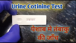 urine cotinine I cotinine urine test I tobacco test [upl. by Bannerman98]