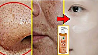 चेहरे की काली परत ऐसे उतरेगी जैसे सालो बाद चेहरा धोयाहोHERBCIENCE Revitalizng ProCollagen Facewash [upl. by Nylesaj]