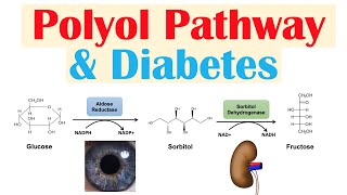 Polyol Pathway amp Diabetes  The Role of Polyol Pathway in Diabetes Pathogenesis [upl. by Anitahs]