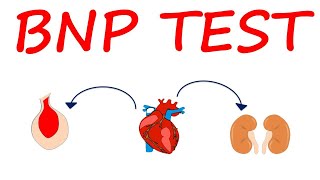 Brain Natriuretic Peptide BNP Test for heart failure [upl. by Carlick]