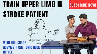 Upper limbHand exercise for paralysisstroke patient [upl. by Bultman]