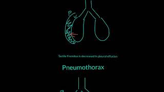 Tactile Fremitus Explained [upl. by Loretta]