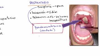 Difteria causas síntomas vacuna tratamiento Infecciosas [upl. by Landis521]