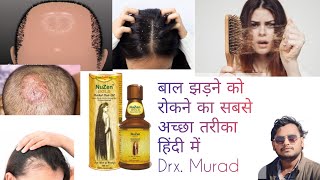 इस तेल से बाल मोटे और लंबे होते हैं  nuzen gold herbal hair oil  best hair growth oil  hair oil [upl. by Zat566]