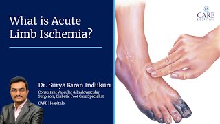 What is Acute Limb Ischemia  Dr Surya Kiran Indukuri  CARE Hospitals Banjara Hills Hyderabad [upl. by Inalaehak]