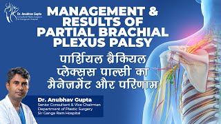 Comprehensive Guide to Partial Plexus Management with Dr Anubhav Gupta [upl. by Biernat674]